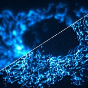 Mitochondrie - widefield (vlevo) vs. SRRF stream (vpravo)