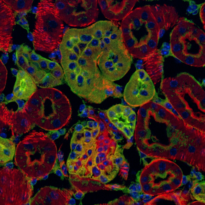 Kvantitativní 3D prostorová analýza tkání kostní dřeně