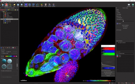 Drosophilia Egg Chamber