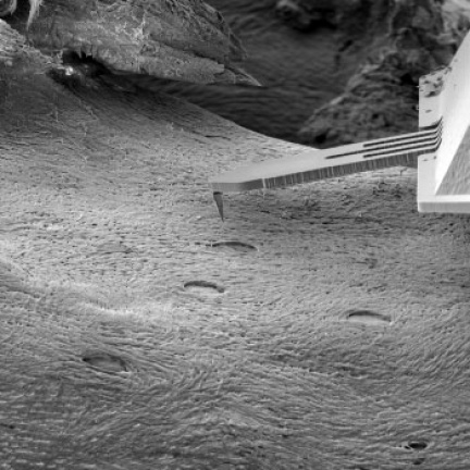 FusionScope se vzorkem kostní tkáně