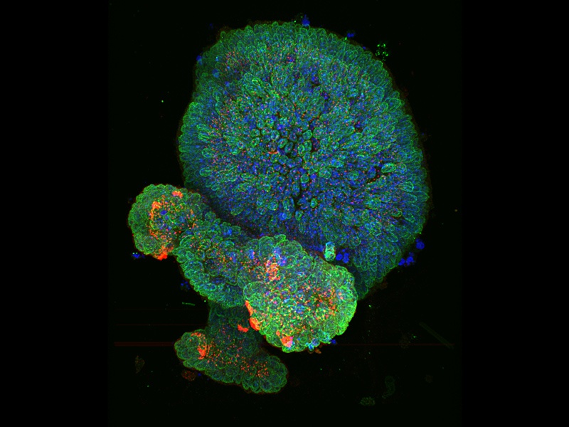 SDCM – Mikroskopie organoidů