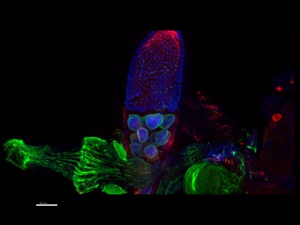 Lokalizace RNA během oogeneze u octomilky v rámci projektu DOT